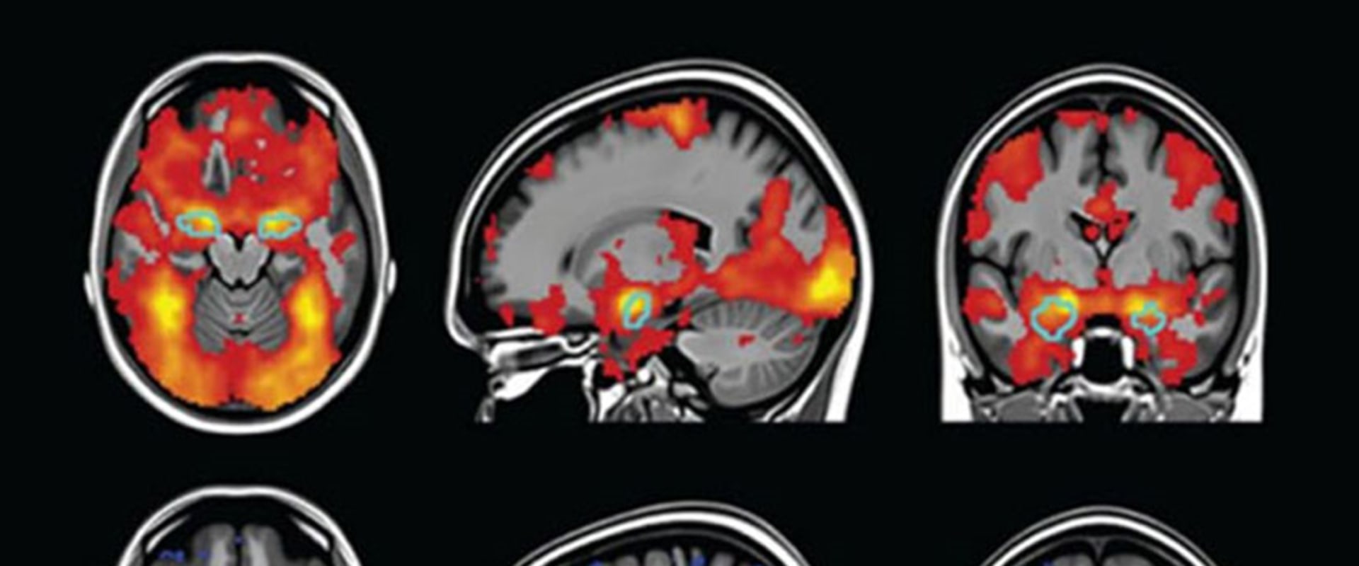 Brain Imaging Tests: A Comprehensive Overview