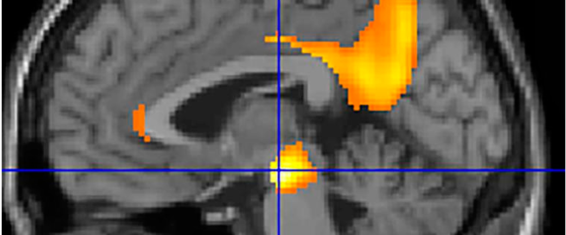 Clinical Diagnosis of Alzheimer's Disease: A Comprehensive Overview
